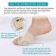 1X (Javító és bunion megkönnyebbülés védő hüvelyek készlet - fájdalom kezelésére a Hallux W0P7-ben)