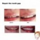 25g - Ideiglenes fogjavító készlet fogfehérítő fogak tömőanyagai rögzítik a fogakat és a hézagokat a hamis fogak