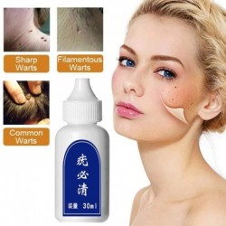 Bőrcímke-eltávolító nemi szemölcs gyors eltávolítása Anyajegy papillómák eltávolításával szembeni lábkukorica