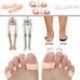 Fehér - 1 pár Bütyök korrektor - Szilikon lábujj korrektor - Távtartó