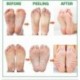 8pair lábmaszk a lábakra fehérítő sima sarok holt bőr eltávolító hámlasztó maszk hámlasztó lábmaszk spa zokni