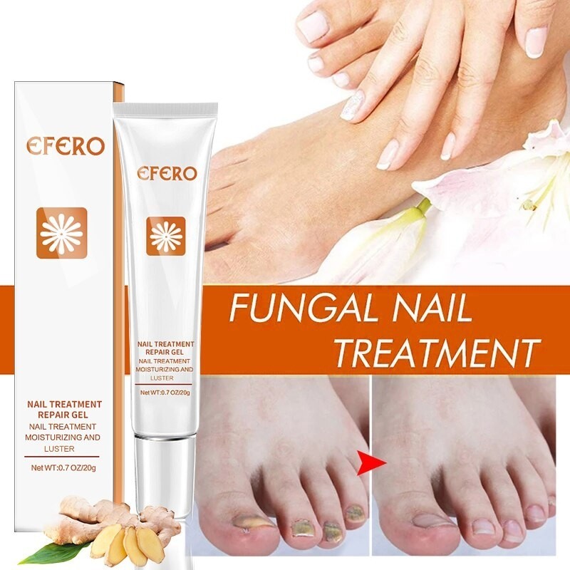 gomba nail foot and treatment)