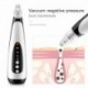Elektromos mitesszer eltávolító vákuumszívó bőr pattanások arctisztító fekete pöttyök pórus tisztító szépség