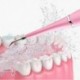 Szín: kék - Hordozható elektromos Sonic Dental Scaler Fogkőeltávolító Fogfoltok Fogkő eszköz Fogorvos Fogfehérítés