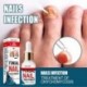 50 ml Nail Repair Essence szérum gombaellenes körömápoló körömgomba eltávolítása tápláló kéz Láb lábujjak